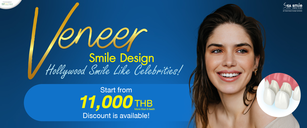 Dental Veneers Phuket Sea Smile Dental Clinic Thailand Dentist