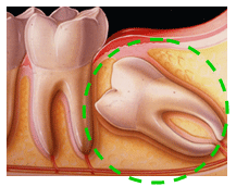 dental surgery