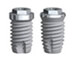 Dental Implant