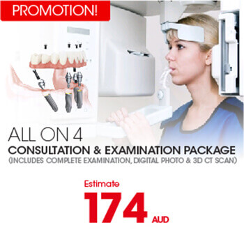 PROMOTIONS