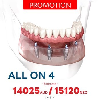 PROMOTIONS