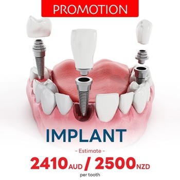PROMOTIONS