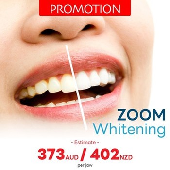 PROMOTIONS