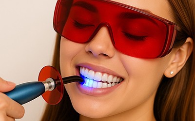 laser teeth whitening