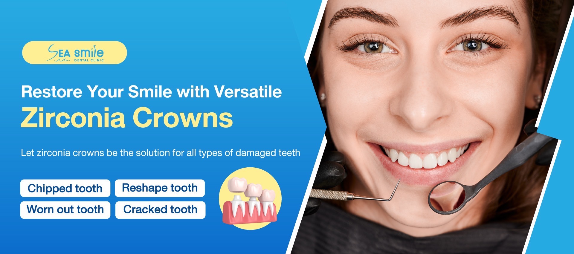 dental crowns