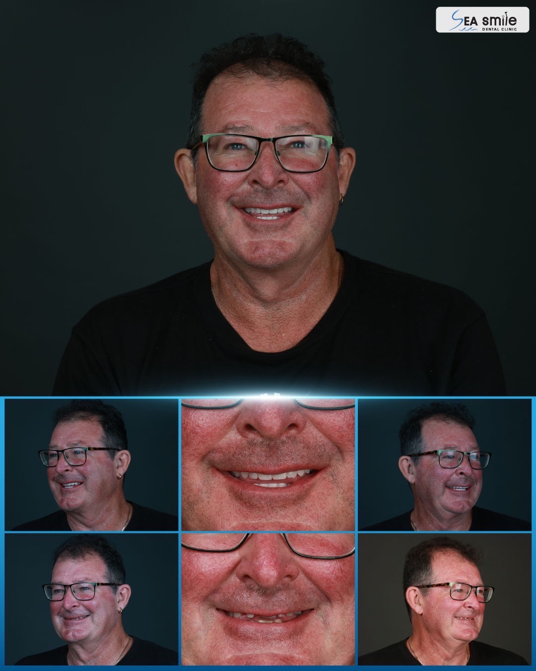 Our Patients All-On-4™