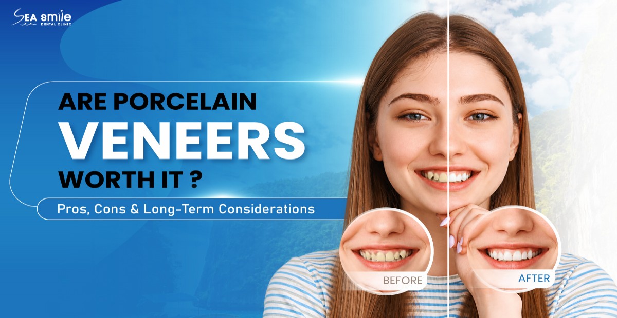 Porcelain Veneers: Are They Right for You?