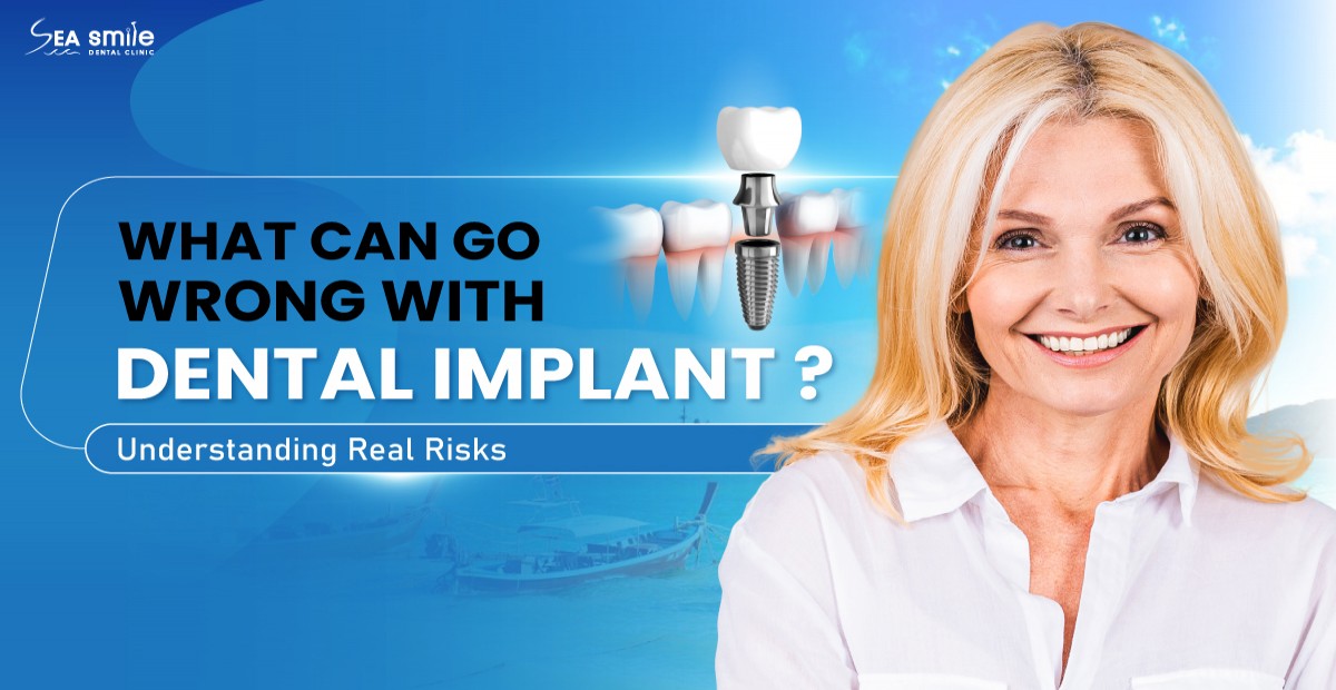 What Can Go Wrong with Dental Implants?