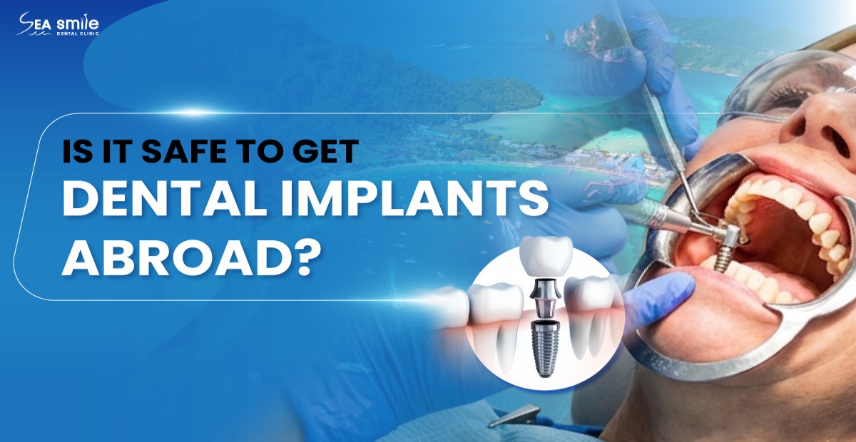 Is It Safe to Get Dental Implants Abroad? The Ultimate Patient Guide to Safe Surgery in Phuket
