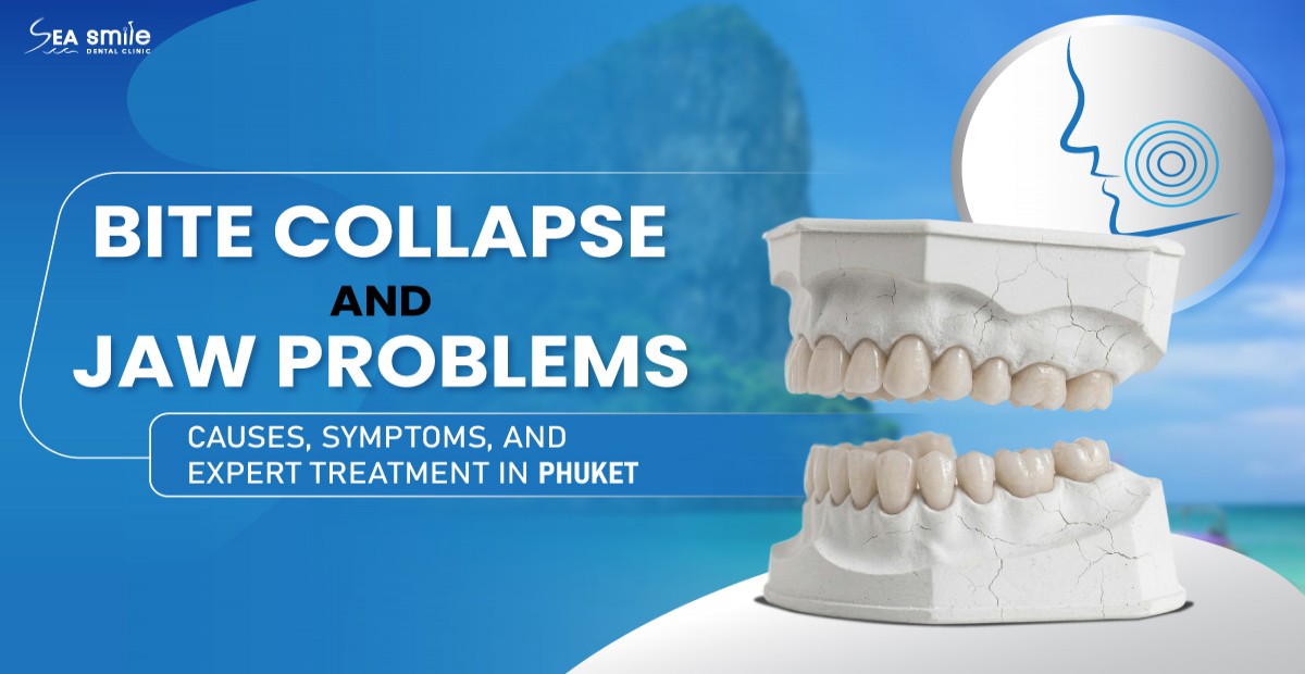 Bite Collapse and Jaw Problems: Causes, Symptoms & Treatment