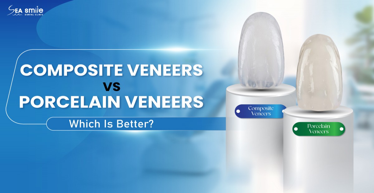 Composite Veneers vs Porcelain Veneers: Which Is Better?