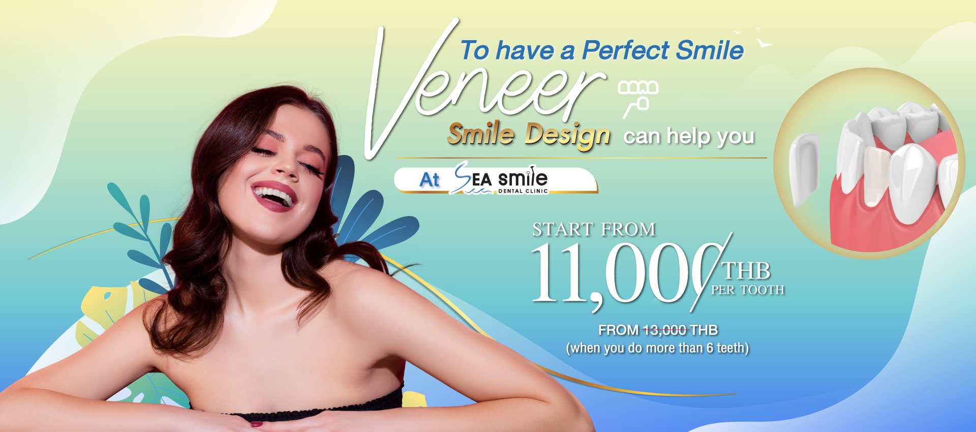 Dental Veneers at Phuket